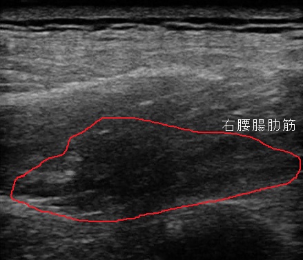 itoh douga2.jpg